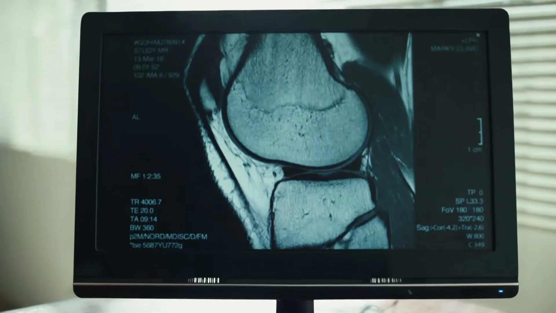 A medical monitor displays an MRI scan of a human knee joint, with various medical data and measurements visible on the screen.