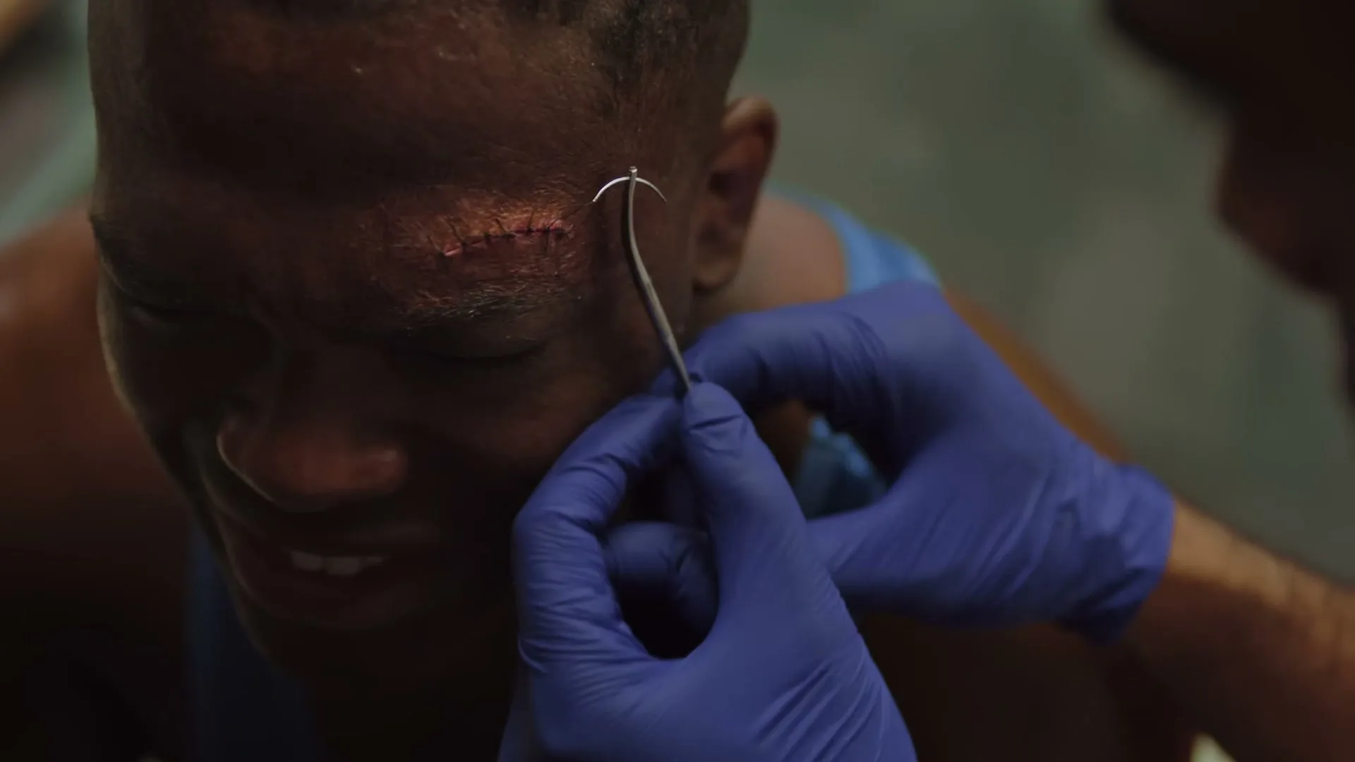 A doctor in blue gloves stitches a cut above a male boxer's eye, who winces in pain in a locker room.