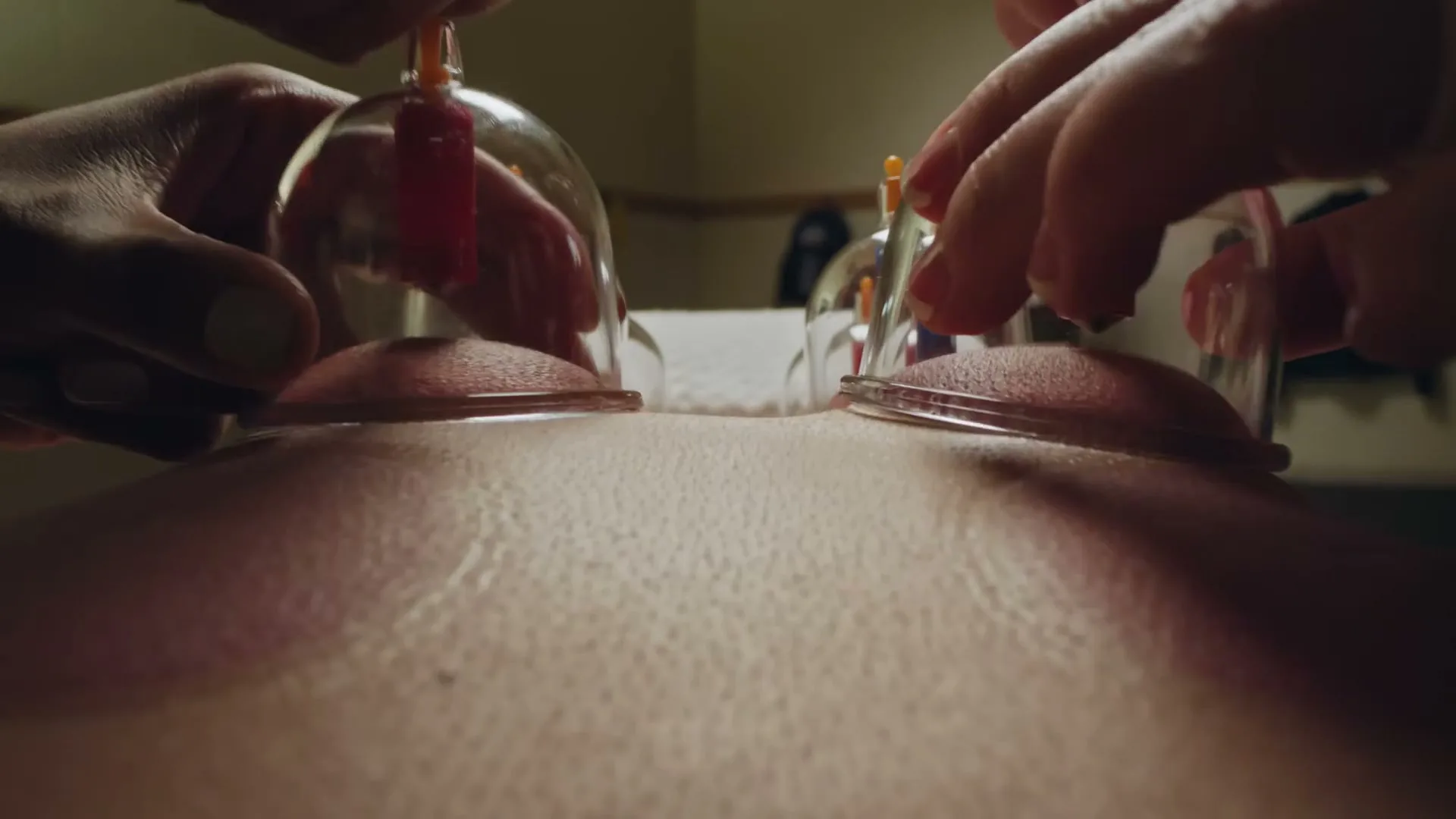 Figs “Anatomy of a Champion”, shot 60