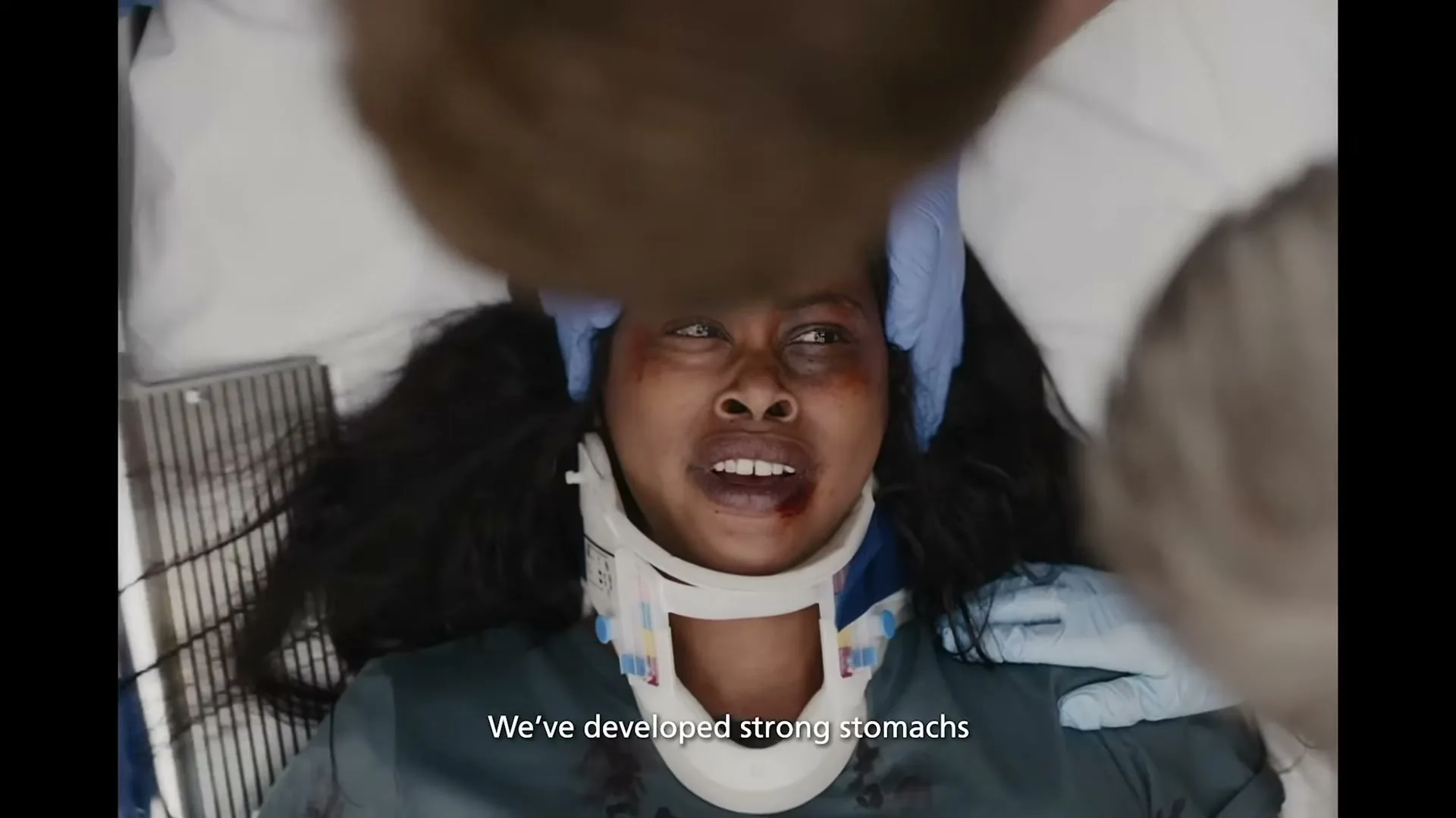 A female patient with a neck brace and facial injuries lies on a stretcher, looking up at medical staff in an emergency room.