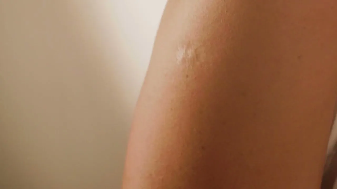 A person's arm is shown in a close-up, revealing a scar as a white t-shirt is pulled away from the skin.