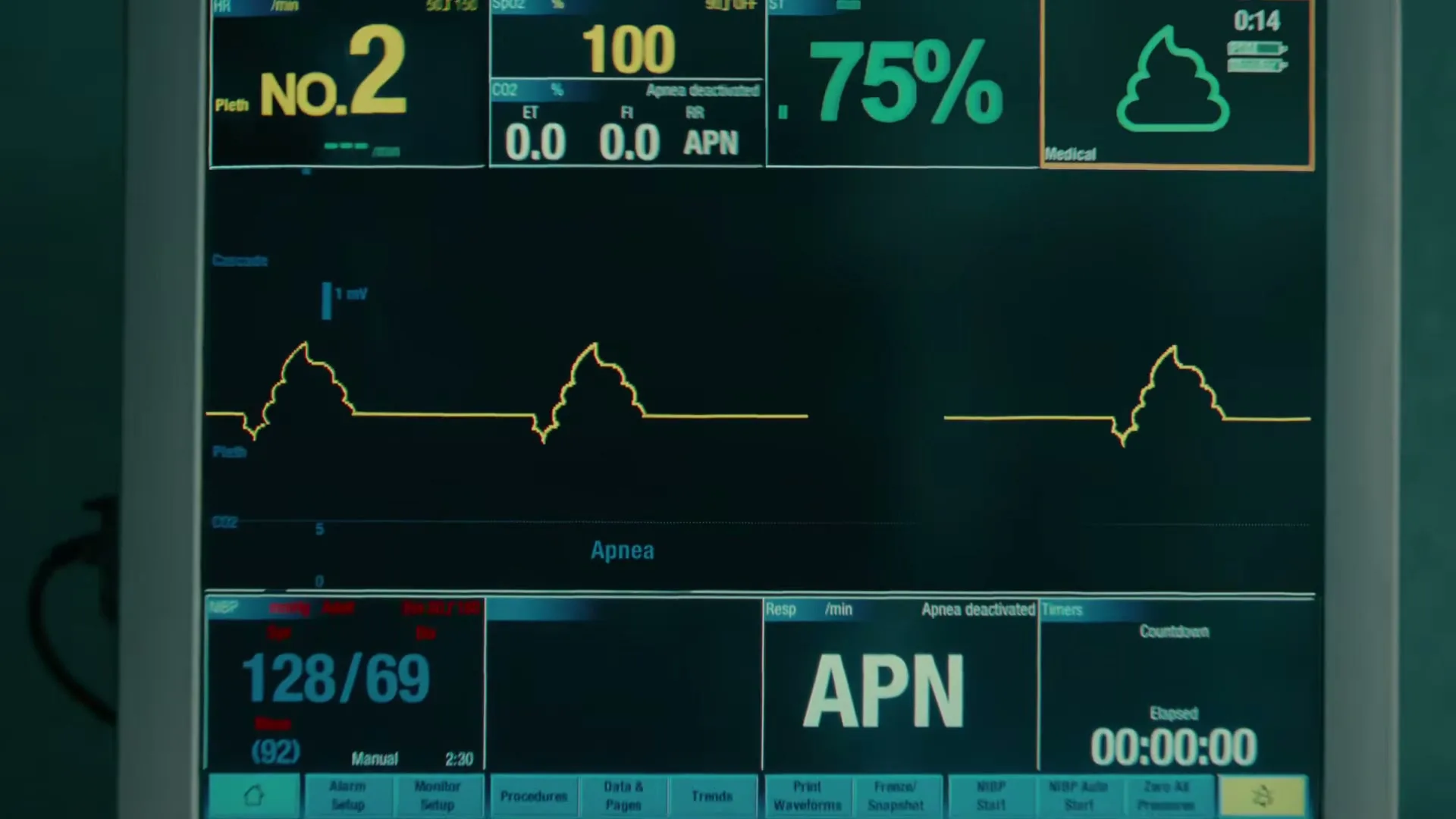 A medical monitor displays vital signs, including a heart rate of 128/69 and a graphic of a pooping emoji, in a hospital room.