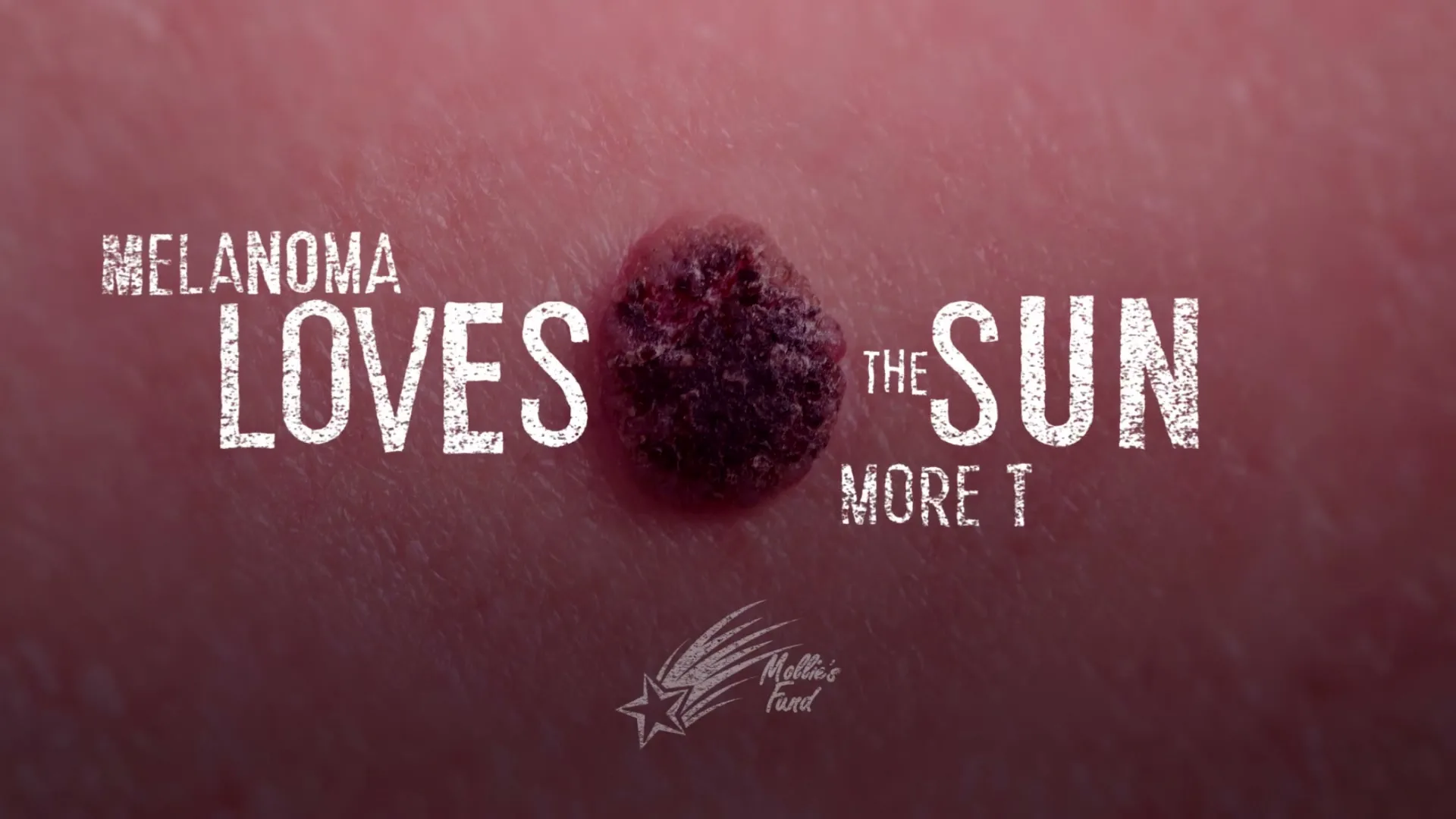 A close-up shot of a dark, irregular mole on human skin, with text appearing over it to deliver a warning message.