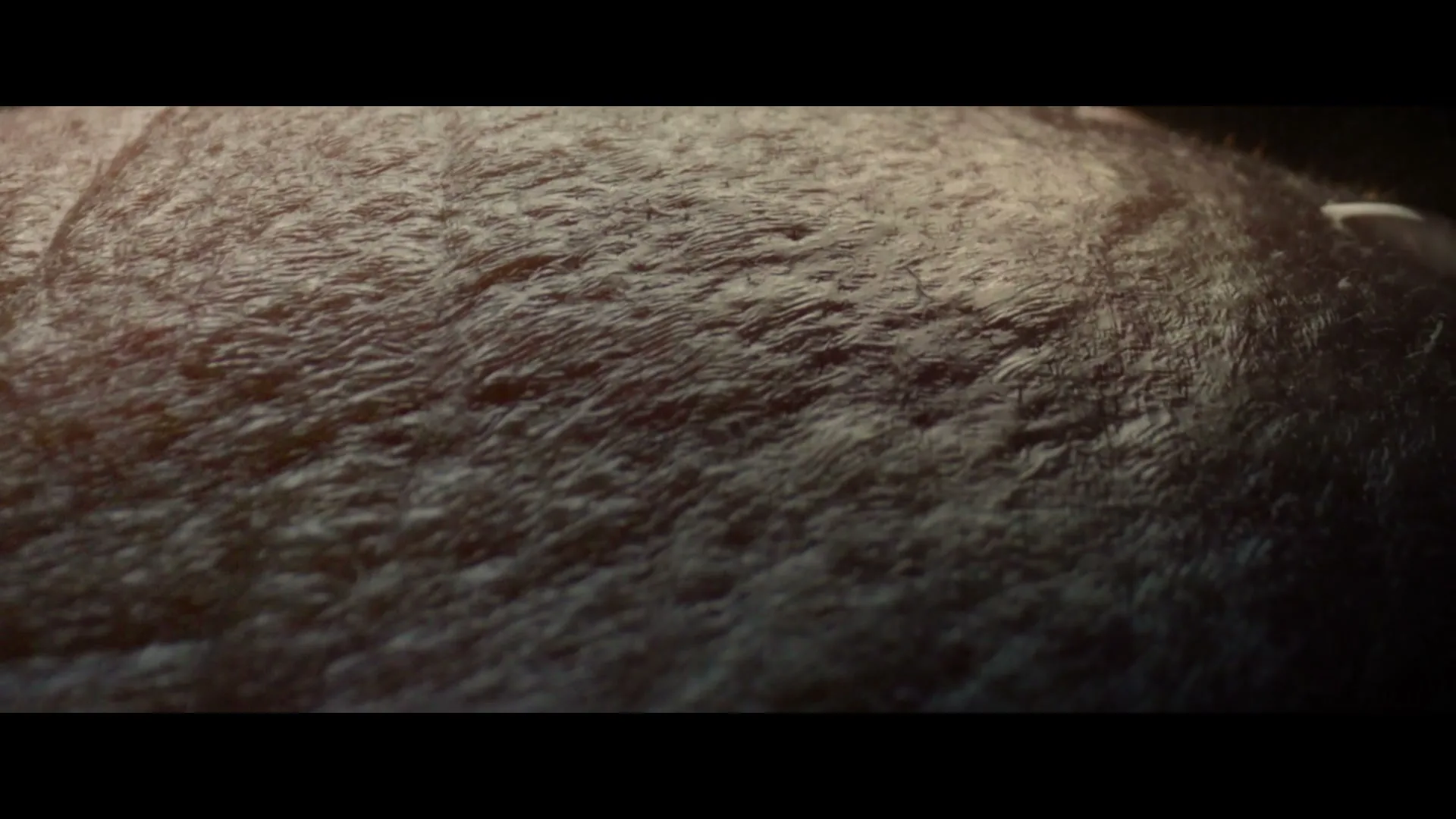 A macro shot of a person's scalp with short hair, showing skin texture and hair follicles, in a dark, indeterminate setting.
