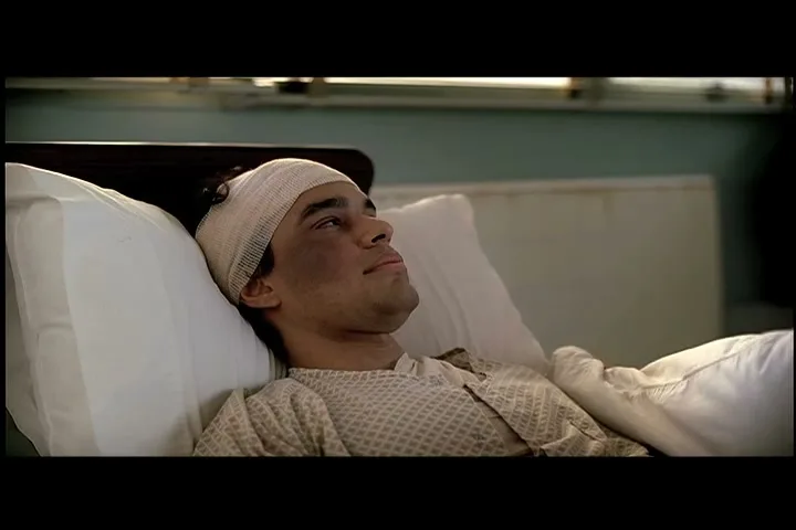 A young man with a bandaged head and bruised face lies in a hospital bed, looking up and to the right, in a hospital room.