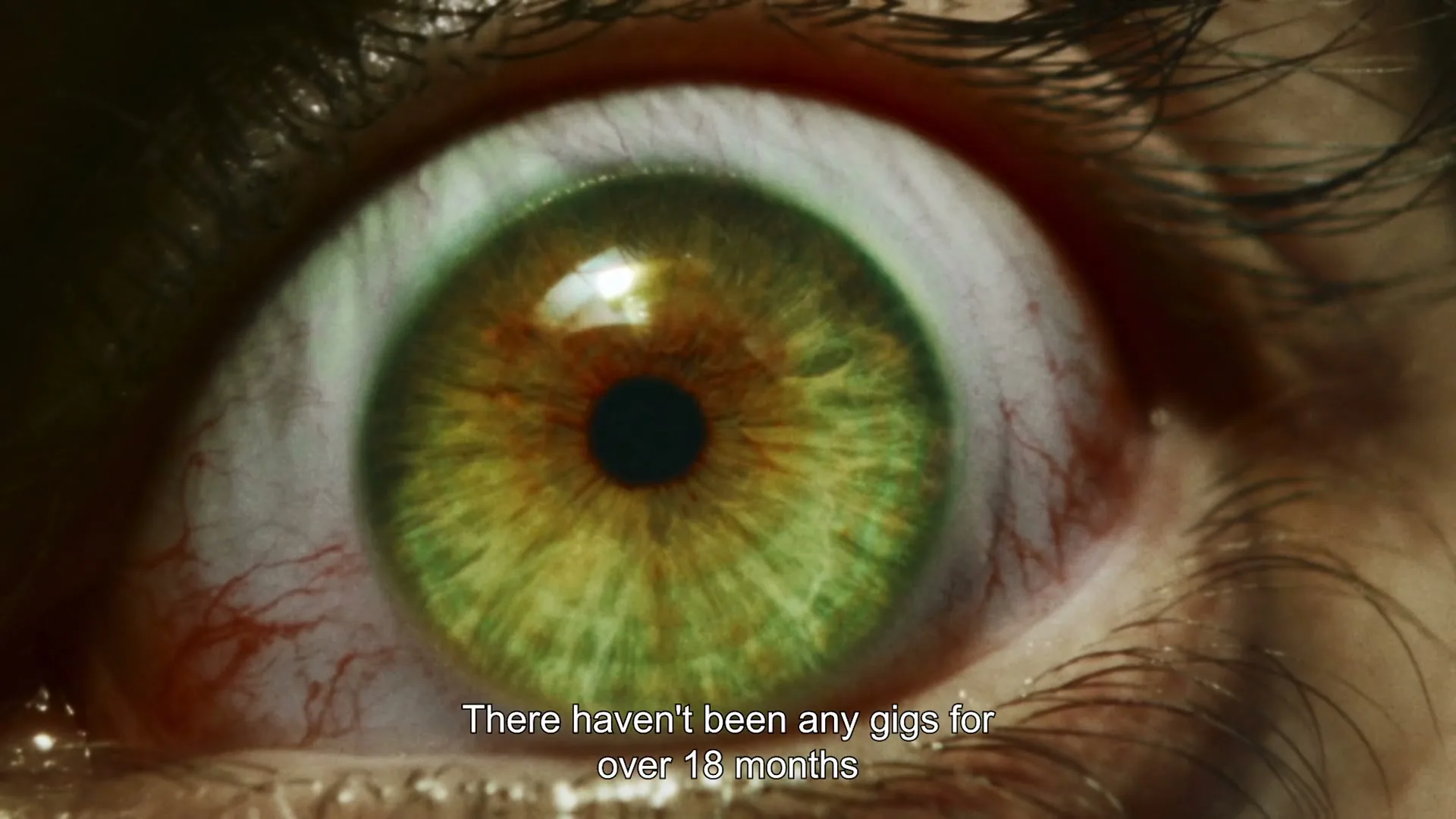 A close-up shot of a person's green eye, bloodshot and wide open, with text appearing on screen.