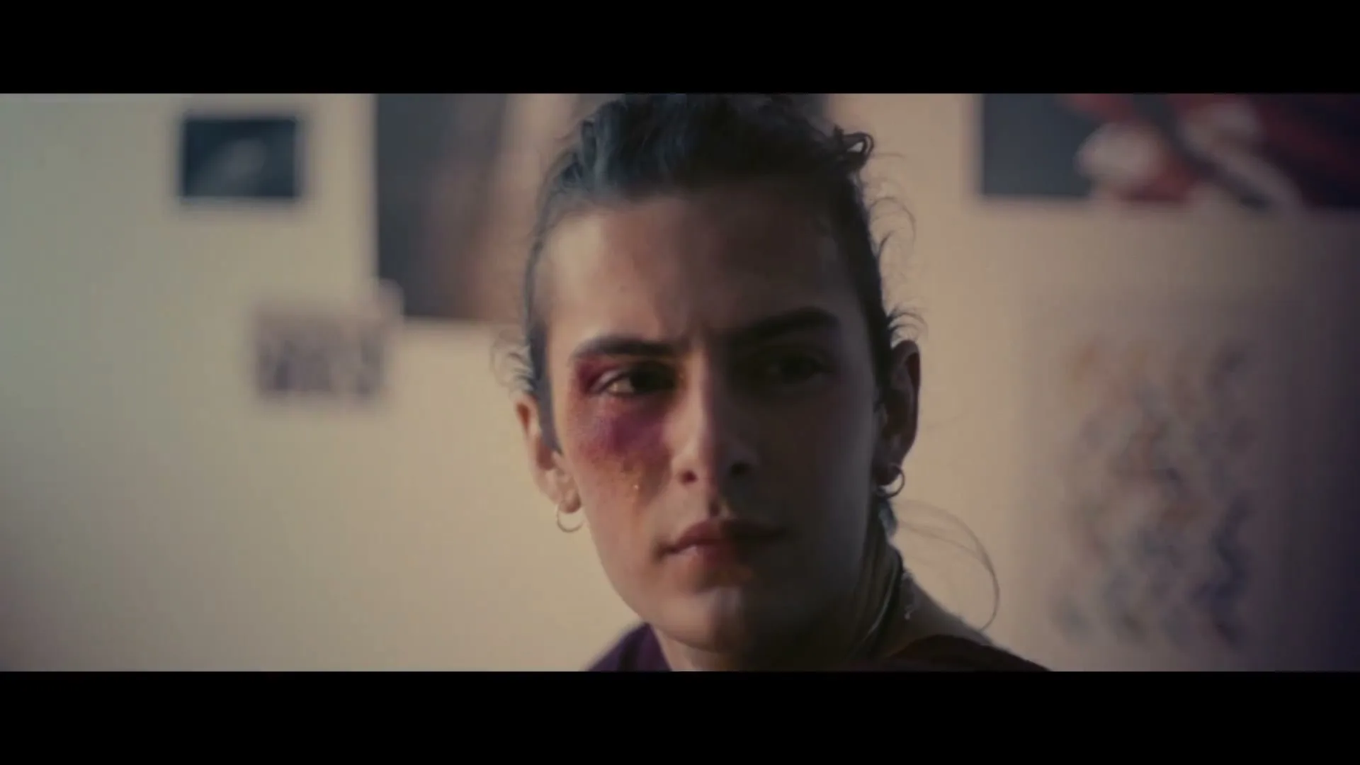 A young person with a bruised eye and lip looks up at the camera, sitting in a dimly lit room.