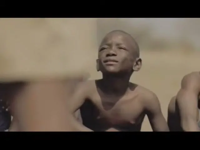 A young, bald boy with dark skin looks up with a hopeful expression, surrounded by other children in a dry, outdoor setting.