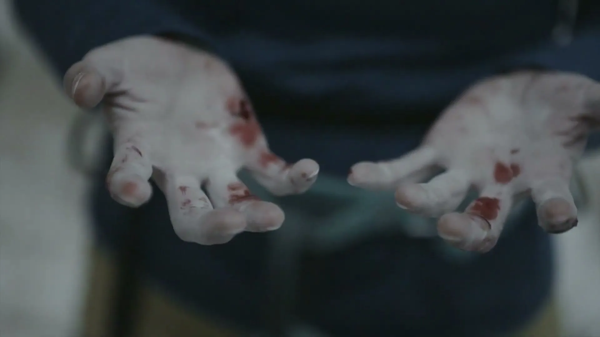 A close-up shot shows a person's hands, covered in blood, as they are held out in front of them, possibly after an injury.