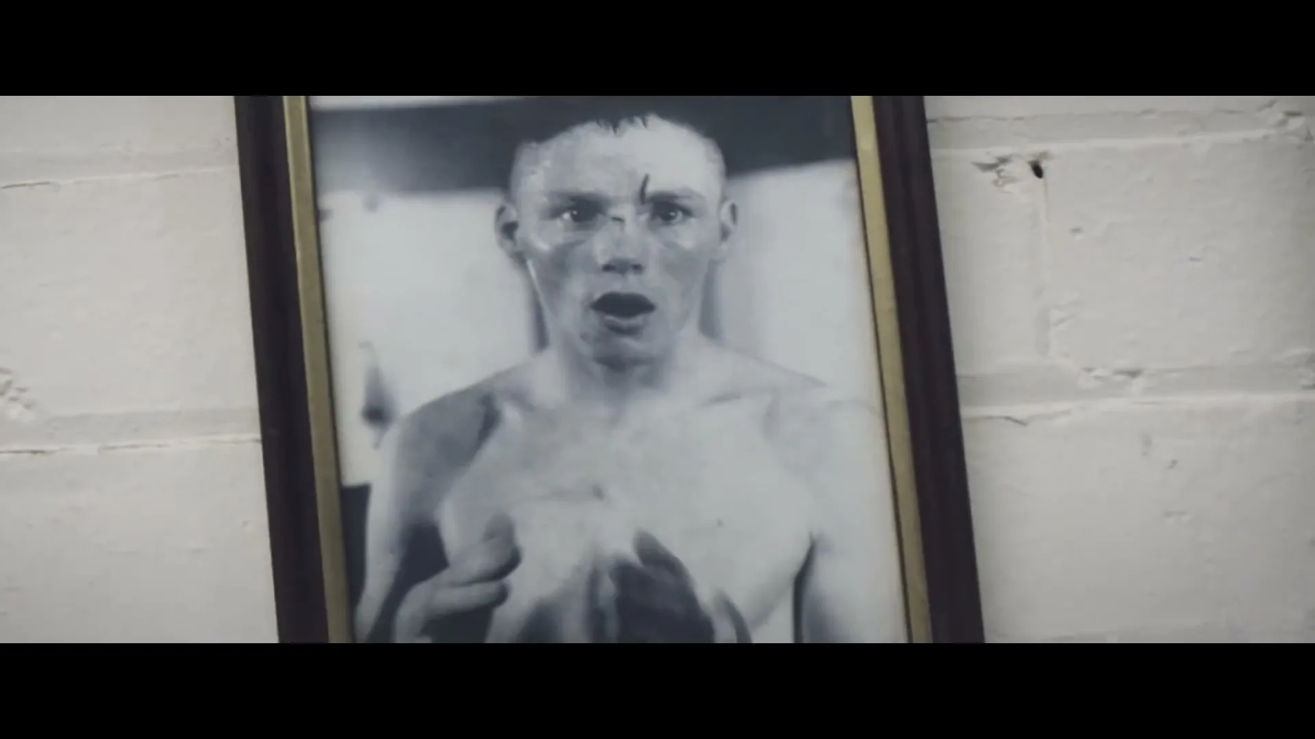A framed black and white photo of a young, shirtless male boxer with a cut on his nose, looking surprised, hangs on a white brick wall.