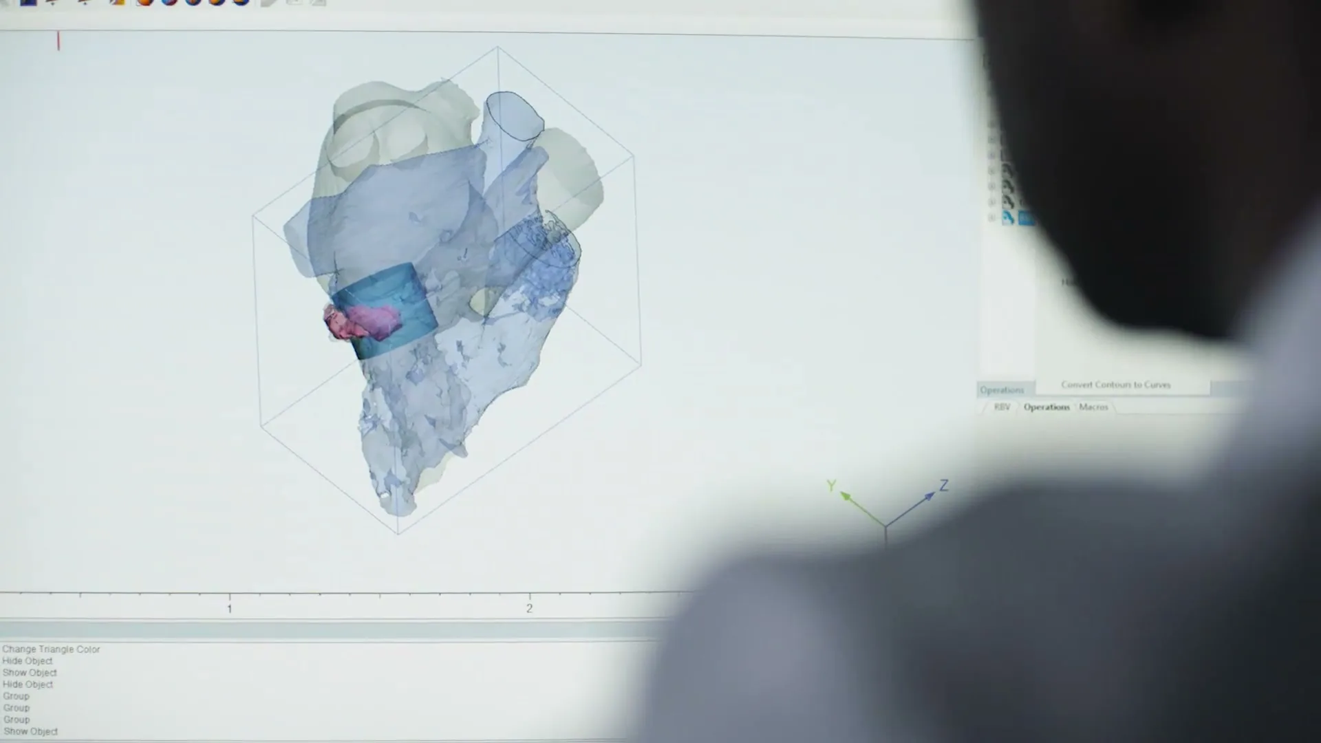 Henry Ford Health "Helen's Heart" (2025) commercial still