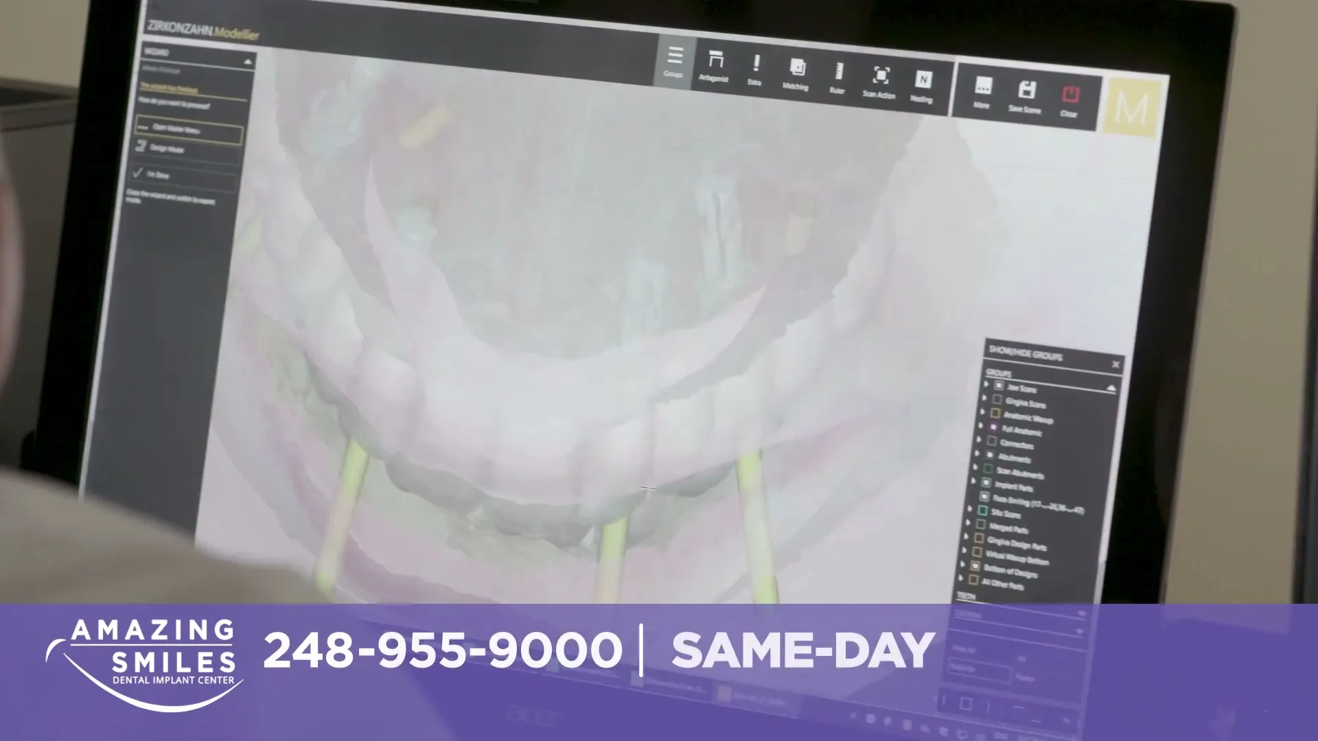 Amazing Smiles "Amazing Smiles" (2025) commercial still