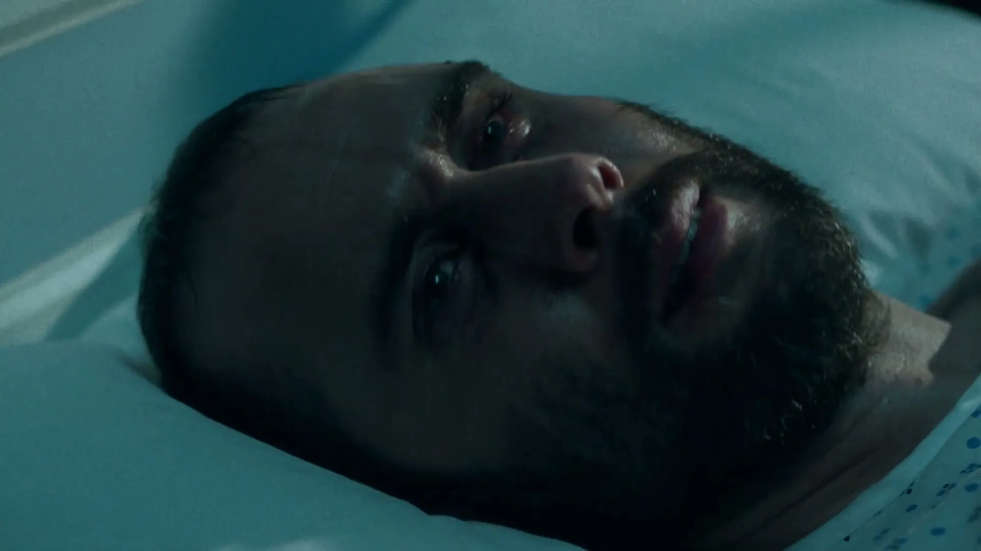 A man with a beard and stitches on his forehead lies in a hospital bed, looking distressed and in pain, in a dimly lit room.