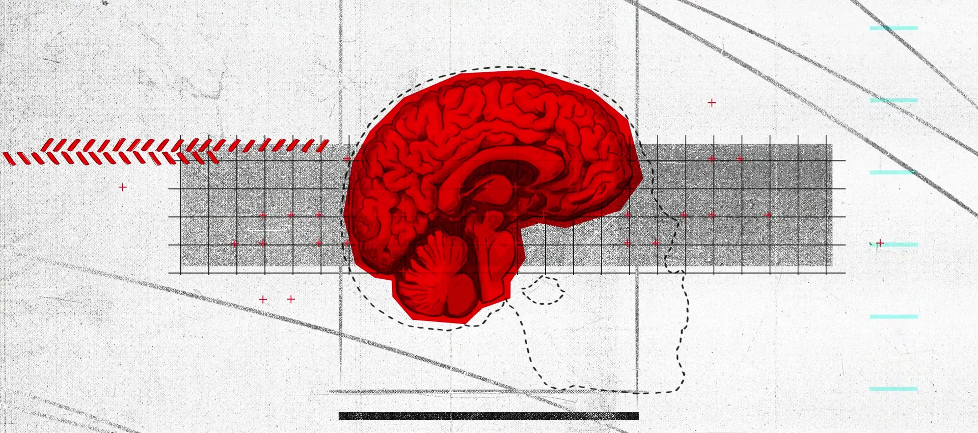 A graphic animation shows a silhouette of a human head with a red brain inside, then transitions to a collage of photos including a man in a hospital bed.