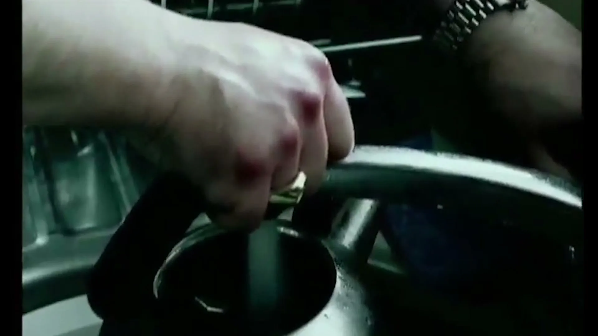 A person's hand, with visible red marks, holds a kettle under running water in a kitchen sink.
