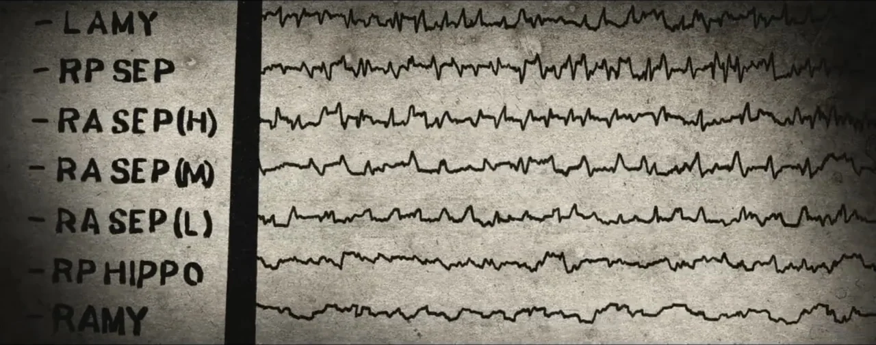 Hunting for Hedonia (2019) movie still: closeup — A close-up view of a medical chart containing multiple EEG brain wave patterns. The paper has…