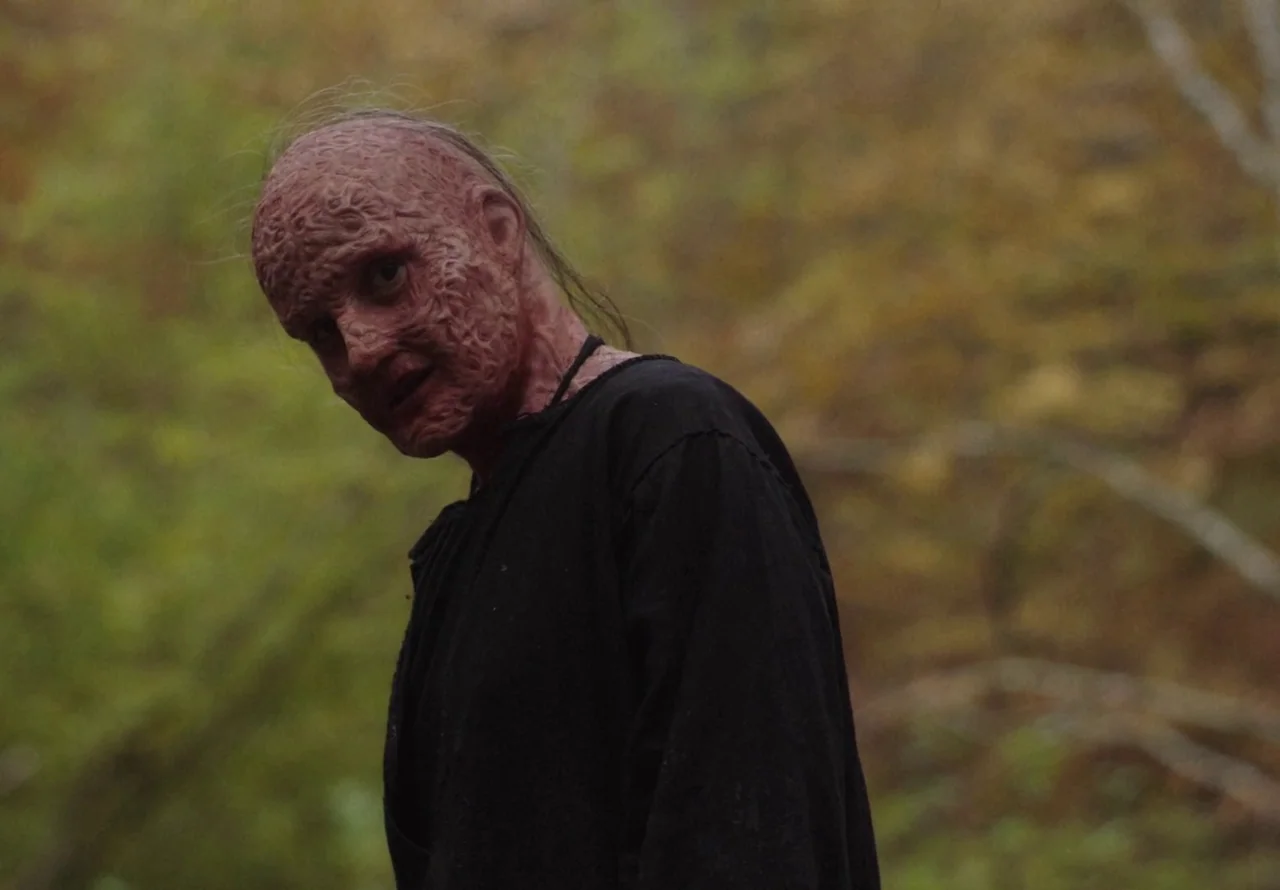 You Won’t Be Alone (2022) movie still: medium — A figure with heavily scarred skin stands in a wooded area with blurred foliage. The individual…