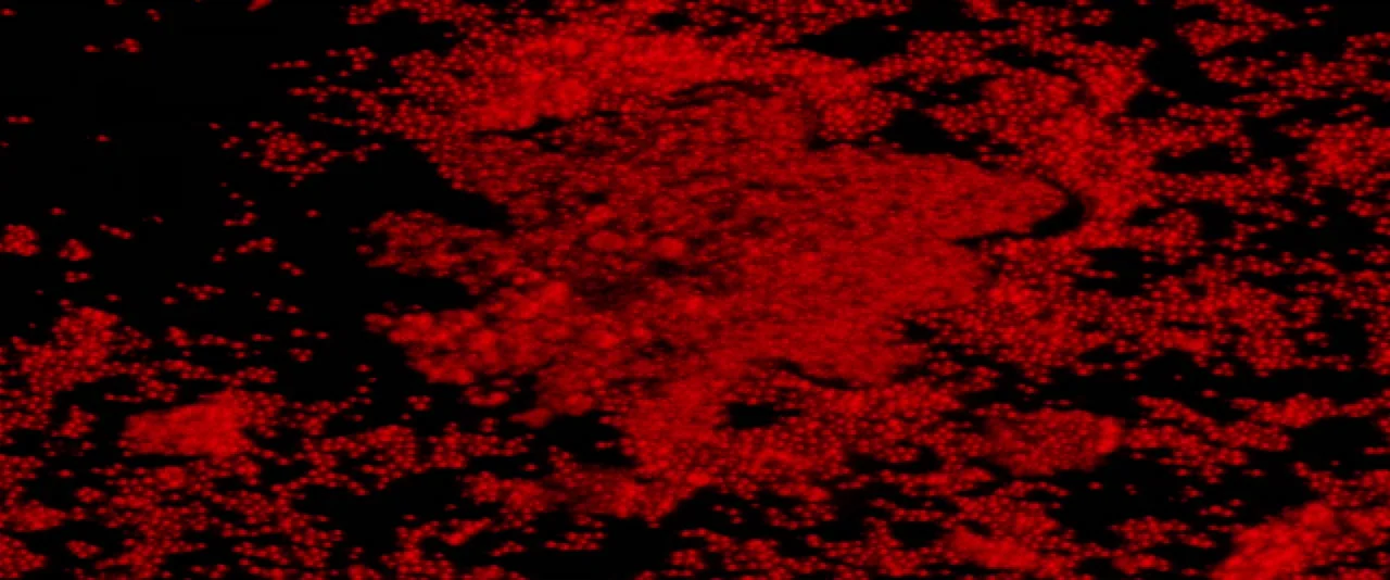 The Hunger (1983) movie still: closeup — A dense accumulation of small red particles floats against a deep black background. The particles vary in…