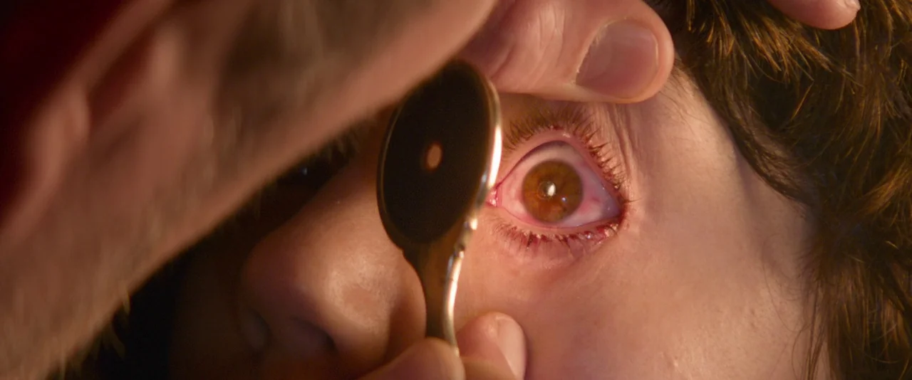 The Dancer movie still: closeup — A close-up view of an eye being inspected during a medical procedure. The person's eye is held open as a handheld…