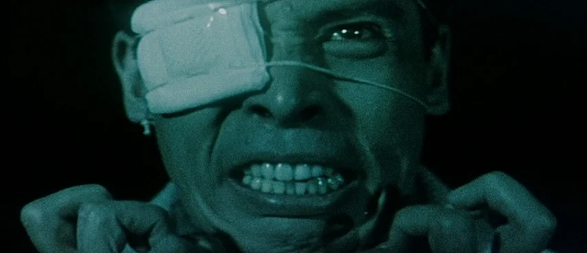 Jigoku (1960) movie still: closeup — A man in extreme close-up wears a white eye patch against a black background. He pulls upward on his shirt…
