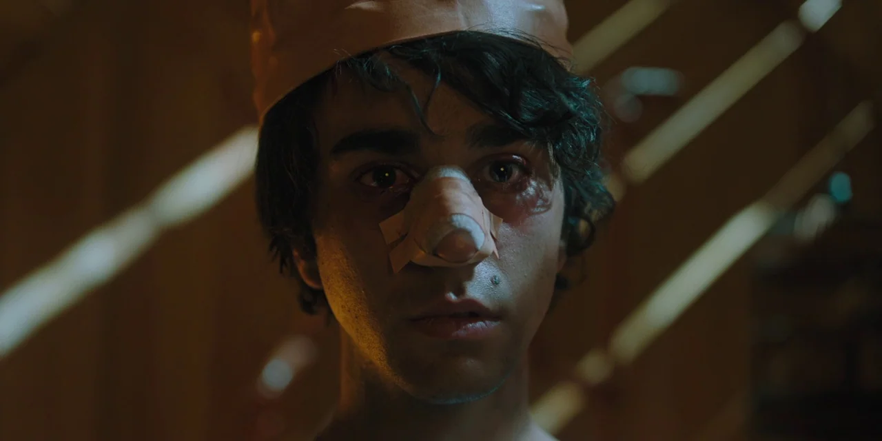 Hereditary (2018) movie still: closeup — A dimly lit indoor space with slatted light beams crossing the background. A young man with a bandaged nose…