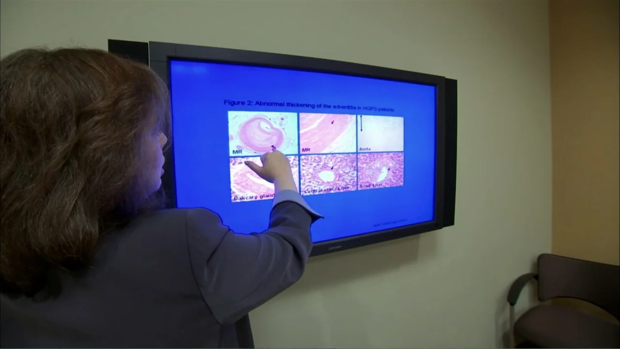 Life According to Sam (2013) movie still: medium — A woman stands before a large wall-mounted monitor displaying histology slides inside a room. She…