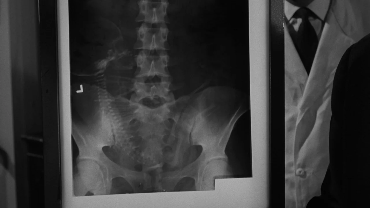 Village of the Damned (1960) movie still: medium — A medical professional in a white coat stands next to a lit X-ray box. The X-ray shows the pelvic…