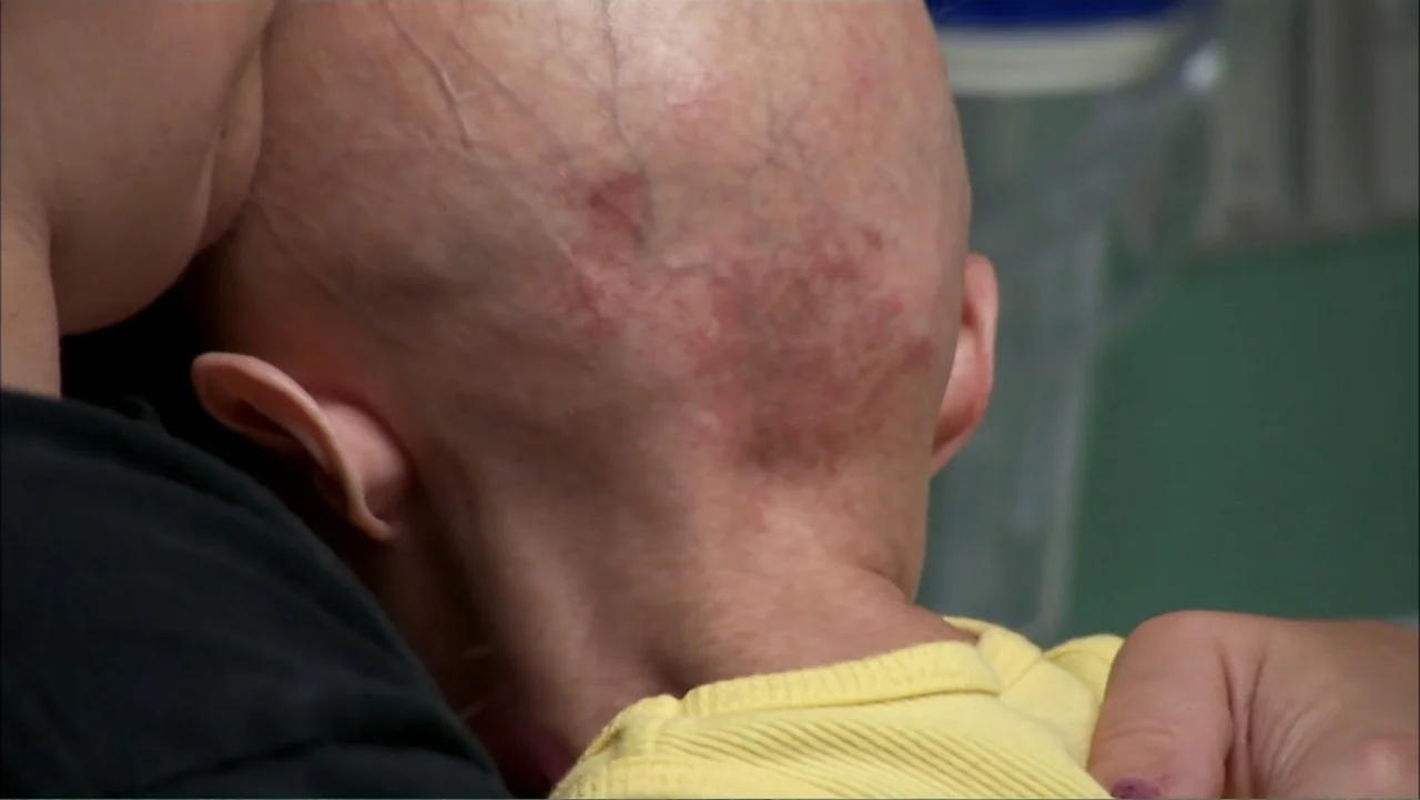 Life According to Sam (2013) movie still: closeup — A close-up view of a child's head against a green-walled interior. An adult woman in a black…