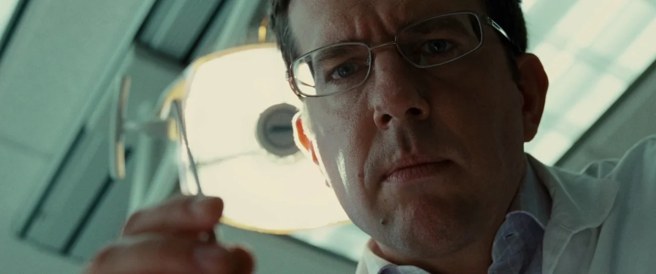 The Hangover Part II (2011) movie still: closeup — A clinical dental space with bright overhead lighting fixtures reflecting against white surfaces.…