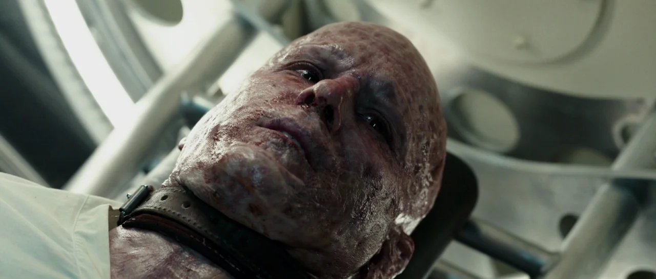 Deadpool (2016) movie still: closeup — A clinical laboratory space with sterile white circular equipment frames the subject's head. A bald man with…