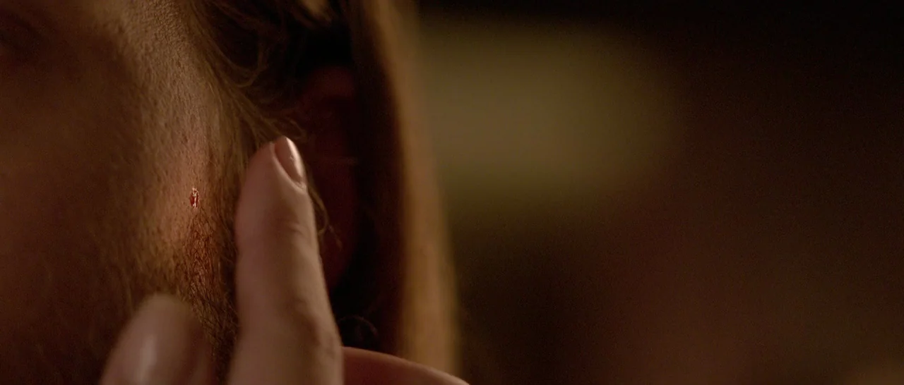 The Invitation (2015) movie still: closeup — A close-up view shows a person's jawline with a small, bleeding puncture wound. A finger rests lightly…