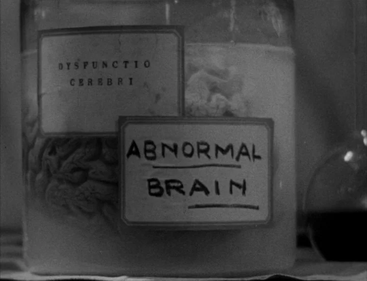 Frankenstein movie still: closeup — A glass medical jar contains a brain submerged in liquid with two paper labels. One label reads 'DYSPUNCTIO…