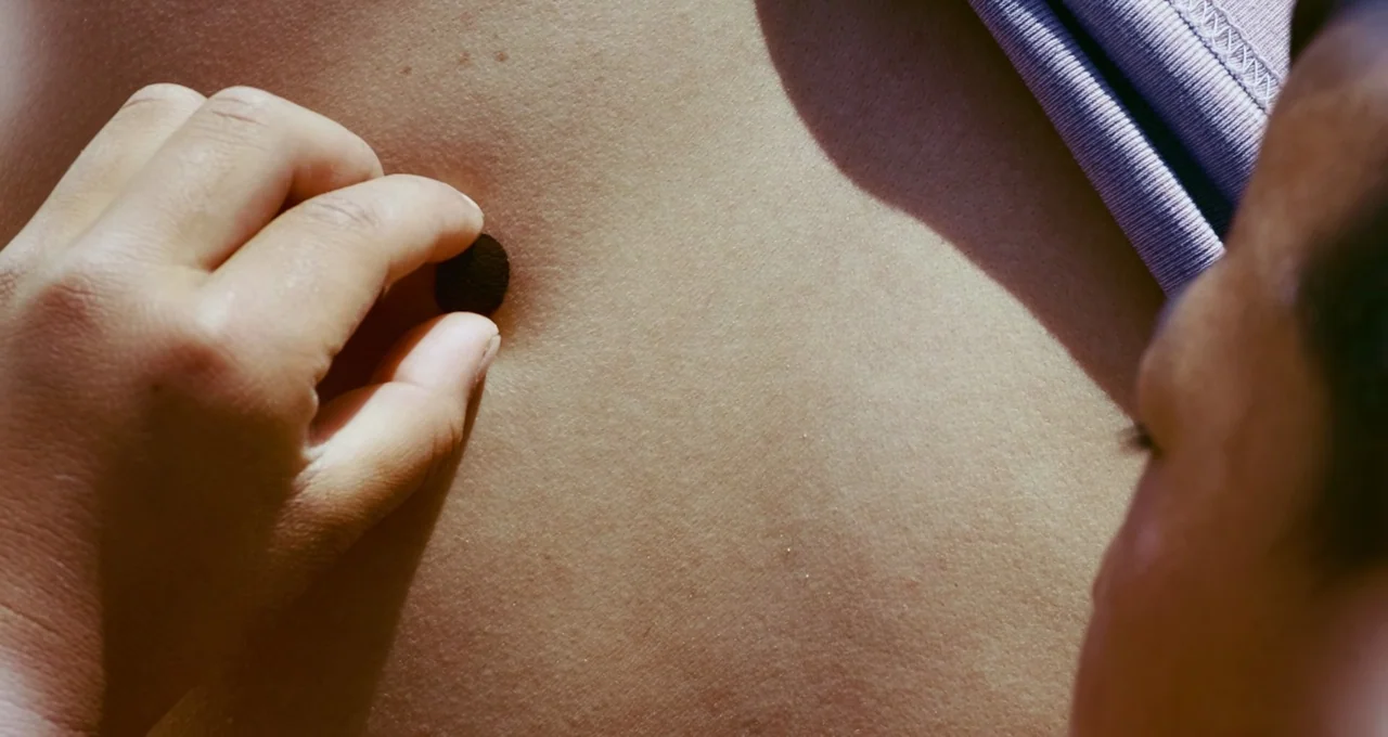 Balloon (2019) movie still: closeup — Close up on a patch of human skin in bright, directional sunlight. A hand applies a small circular black…
