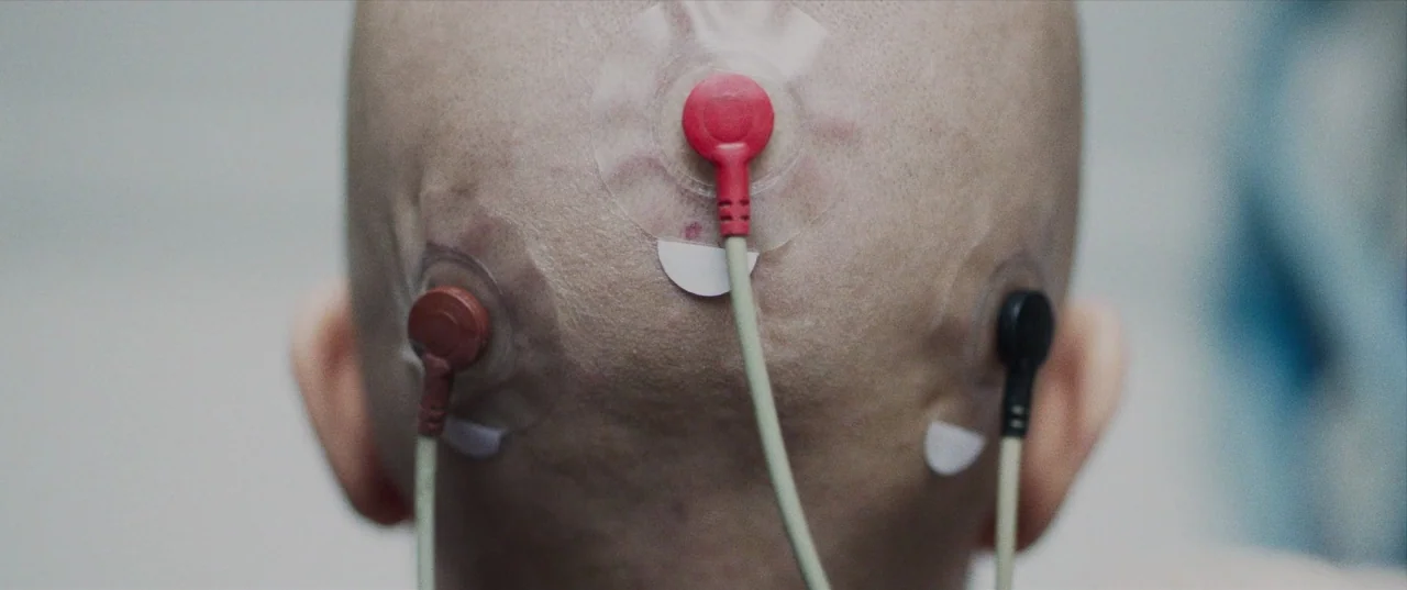 The Perfection (2018) movie still: closeup — A close-up view shows the back of a shaved human head in a room. Three colored medical electrodes are…