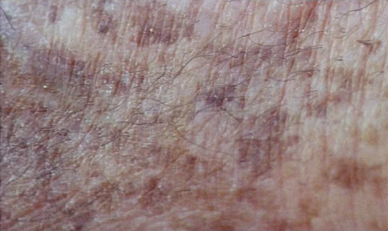 Jacquot de Nantes (1991) movie still: closeup — A close-up view of human skin with visible pores and fine body hairs. The surface shows varied…