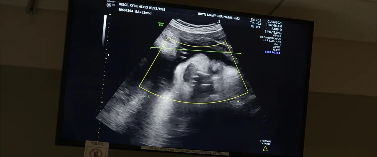 Kelce (2023) movie still: closeup — A dark medical exam room features a wall-mounted monitor showing a prenatal ultrasound scan. The screen displays…