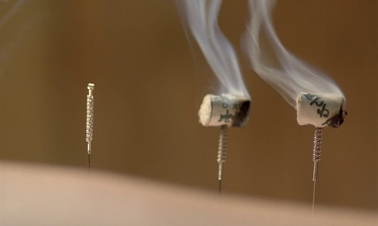The Scent of Green Papaya (1993) movie still: closeup — A close-up shows three metallic acupuncture needles inserted into human skin with moxa…