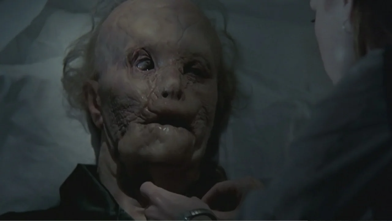 Hannibal (2001) movie still: closeup — A dimly lit hospital room features a patient with severe facial scarring resting in bed. A medical…