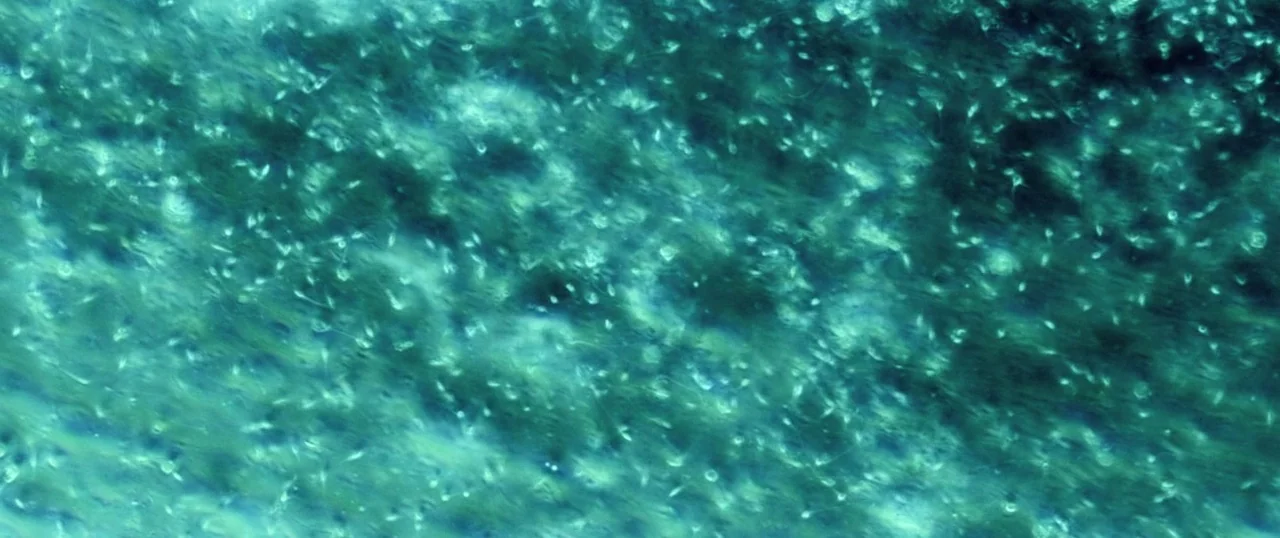 Sea Fever (2019) movie still: closeup — A microscopic view of numerous tiny organisms swimming through a greenish fluid. The organisms appear as…